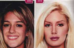 Plastic Surgery’s Younger Audience